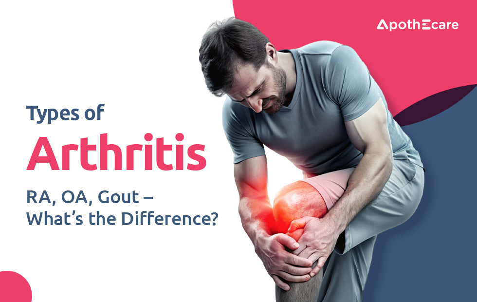 Types of Arthritis: RA, OA, Gout – What’s the Difference?