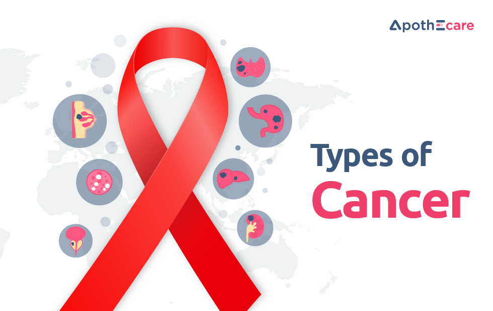 Types of Cancer