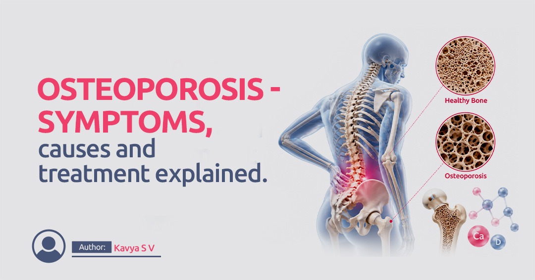 Osteoporosis - Symptoms, causes and treatment explained